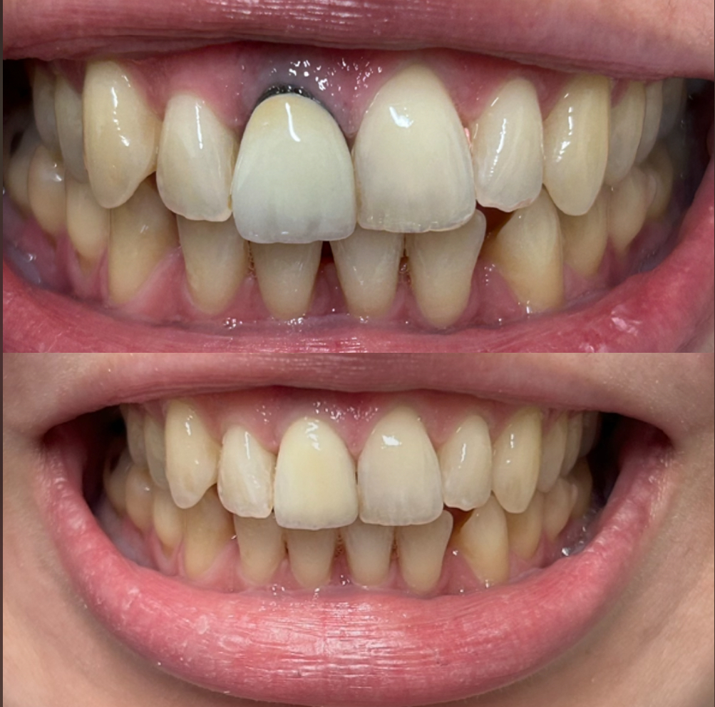 Ridgeway Dental in St Clair Shores